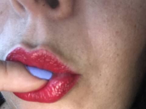 hotlip